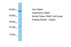 ZNF816-ZNF321P Rabbit anti-Human, Polyclonal, Novus Biologicals 0.1 mL | Buy Online | Novus Biologicals | Fisher Scientific